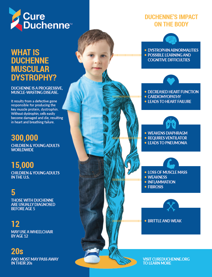 Duchenne Muscular Dystrophy